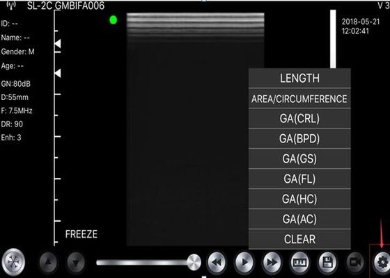 5G 포켓용 초음파 스캐너 컨벡스 : 선인 3.5~5MHz : 심장병인 7.5~10MHz : 2.5~5MHz