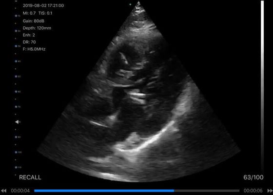 5G 포켓용 초음파 스캐너 컨벡스 : 선인 3.5~5MHz : 심장병인 7.5~10MHz : 2.5~5MHz