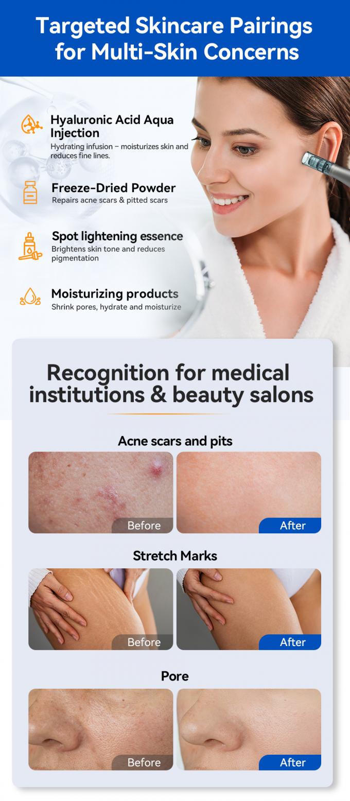 신제품 하이드라 펜 H5 메조테라피 세럼 어플리케이터 뷰티 스킨케어 바이오 엑소좀 더마 마이크로니들링 펜 6