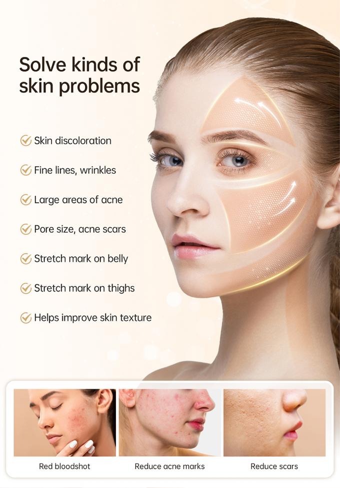 최신 4극 EMS 자동 혈청 어플리케이터 하이드라 펜 H5 페이스 스킨 더마 마이크로니들링 펜 에센스 콜라겐 재생 3