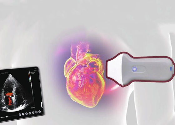 PDI 와이파이 무선 전신 휴대용 초음파 스캐너 128 요소